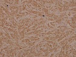 Invitrogen TAK1 Polyclonal Antibody 100 &mu;L; Unconjugated:Antibodies,
