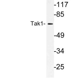 Invitrogen TAK1 Polyclonal Antibody 100 &mu;L; Unconjugated:Antibodies,