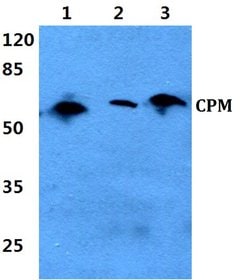 Invitrogen&trade;&nbsp;Carboxypeptidase M Polyclonal Antibody