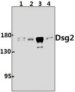 Invitrogen Desmoglein 2 Polyclonal Antibody 100 &mu;L; Unconjugated:Antibodies,