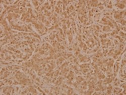 Invitrogen PAF49 Polyclonal Antibody 100 &mu;L; Unconjugated:Antibodies,
