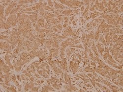 Invitrogen NXPH1 Polyclonal Antibody 100 &mu;L | Buy Online | Invitrogen&trade; | Fisher Scientific