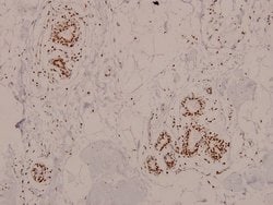 Invitrogen Phospho-ATM (Ser1981) Polyclonal Antibody 100 &mu;L; Unconjugated:Antibodies,