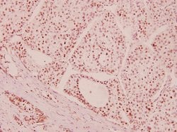 Invitrogen ATM Polyclonal Antibody 100 &mu;L; Unconjugated:Antibodies,