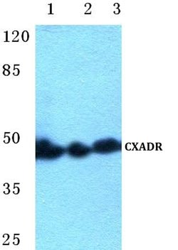 Invitrogen CAR Polyclonal Antibody 100 &mu;L | Buy Online | Invitrogen&trade; | Fisher Scientific