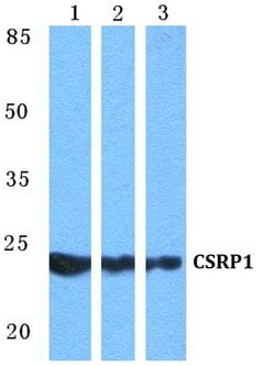 Invitrogen CRP1 Polyclonal Antibody 100 &mu;L | Buy Online | Invitrogen&trade; | Fisher Scientific