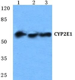 Invitrogen CYP2E1 Polyclonal Antibody 100 &mu;L | Buy Online | Invitrogen&trade; | Fisher Scientific