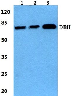 Invitrogen Dopamine beta Hydroxylase Polyclonal Antibody 100 &mu;L | Buy Online | Invitrogen&trade; | Fisher Scientific