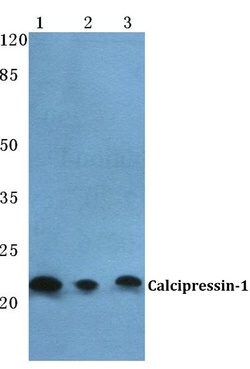 Invitrogen RCAN1 Polyclonal Antibody 100 &mu;L; Unconjugated:Antibodies,