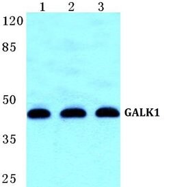 Invitrogen GALK1 Polyclonal Antibody 100 &mu;L; Unconjugated:Antibodies,