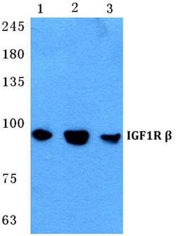 Invitrogen IGF1R (CD221) Polyclonal Antibody 100 &mu;L; Unconjugated:Antibodies,
