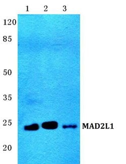 MAD2 Polyclonal Antibody:Antibodies, Polyclonal