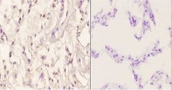 Invitrogen Menin Polyclonal Antibody 100 &mu;L; Unconjugated:Antibodies,
