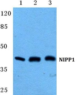 Invitrogen PPP1R8 Polyclonal Antibody 100 &mu;L; Unconjugated:Antibodies,