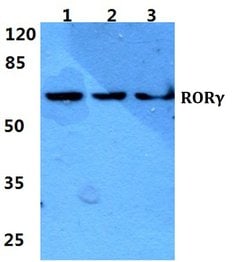 Invitrogen ROR gamma (t) Polyclonal Antibody 100 μL; Unconjugated:Antibodies,