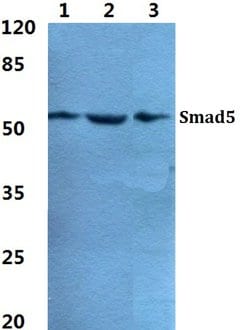 Invitrogen SMAD5 Polyclonal Antibody 100 &mu;L; Unconjugated:Antibodies,