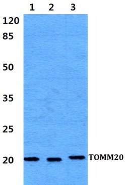 Invitrogen TOMM20 Polyclonal Antibody 100 &mu;L; Unconjugated:Antibodies,