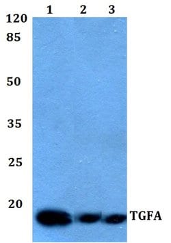 Invitrogen TGF alpha Polyclonal Antibody 100 &mu;L; Unconjugated:Antibodies,