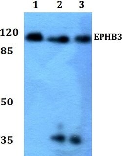 Invitrogen EphB3 Polyclonal Antibody 100 &mu;L | Buy Online | Invitrogen&trade; | Fisher Scientific