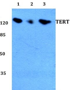 Invitrogen TERT Polyclonal Antibody 100 &mu;L; Unconjugated:Antibodies,