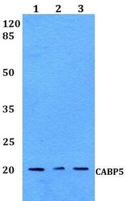 Invitrogen CABP5 Polyclonal Antibody 100 &mu;L; Unconjugated:Antibodies,