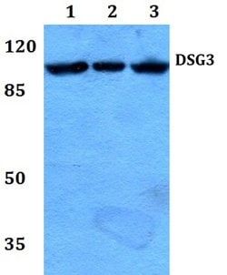 Invitrogen Desmoglein 3 Polyclonal Antibody 100 &mu;L; Unconjugated:Antibodies,