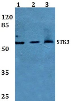 Invitrogen MST2 Polyclonal Antibody 100 &mu;L; Unconjugated:Antibodies,