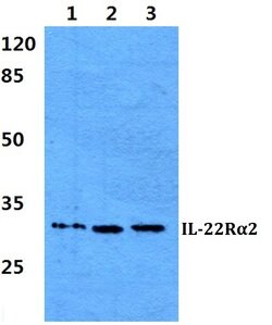 Invitrogen IL22RA2 Polyclonal Antibody 100 &mu;L; Unconjugated:Antibodies,