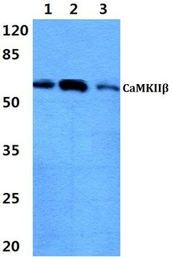 Invitrogen CaMKII beta Polyclonal Antibody 100 &mu;L; Unconjugated:Antibodies,