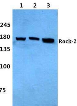 Invitrogen ROCK2 Polyclonal Antibody 100 &mu;L; Unconjugated:Antibodies,
