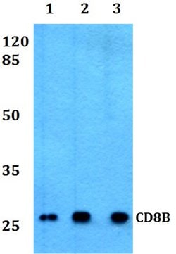 CD8 beta Polyclonal Antibody:Antibodies, Polyclonal