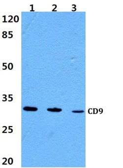 Invitrogen CD9 Polyclonal Antibody 100 &mu;L; Unconjugated:Antibodies,