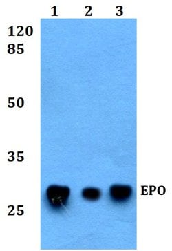 Invitrogen Epo Polyclonal Antibody 100 &mu;L; Unconjugated:Antibodies,