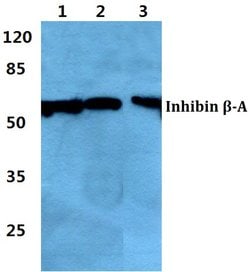 Invitrogen Activin A Polyclonal Antibody 100 &mu;L | Buy Online | Invitrogen&trade; | Fisher Scientific
