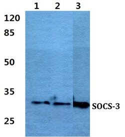 Invitrogen SOCS3 Polyclonal Antibody 100 &mu;L; Unconjugated:Antibodies,