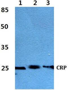 Invitrogen CRP Polyclonal Antibody 100 &mu;L; Unconjugated:Antibodies,
