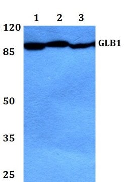 Invitrogen GLB1 Polyclonal Antibody 100 μL; Unconjugated:Antibodies,
