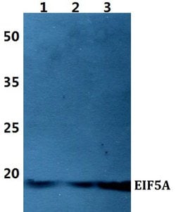 Invitrogen eIF5A Polyclonal Antibody 100 &mu;L | Buy Online | Invitrogen&trade; | Fisher Scientific