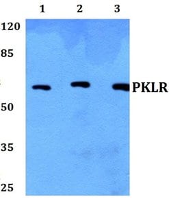 Invitrogen PKLR Polyclonal Antibody 100 &mu;L; Unconjugated:Antibodies,