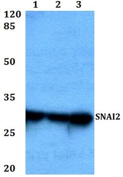 Invitrogen SLUG Polyclonal Antibody 100 &mu;L; Unconjugated:Antibodies,