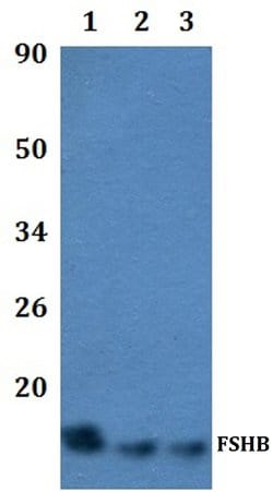 Follicle Stimulating Hormone Polyclonal Antibody, Invitrogen 100 &mu;L;