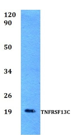 Invitrogen CD268 (BAFF Receptor) Polyclonal Antibody 100 &mu;L; Unconjugated:Antibodies,