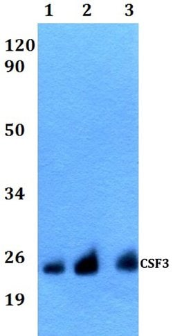 Invitrogen G-CSF Polyclonal Antibody 100 &mu;L | Buy Online | Invitrogen&trade; | Fisher Scientific