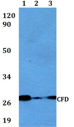 Invitrogen Complement Factor D Polyclonal Antibody 100 &mu;L; Unconjugated:Antibodies,