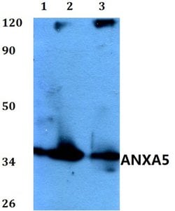 Annexin V Polyclonal Antibody:Antibodies, Polyclonal