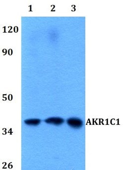 Invitrogen AKR1C1 Polyclonal Antibody 100 &mu;L; Unconjugated:Antibodies,