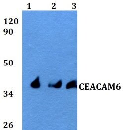 Invitrogen CEACAM6 Polyclonal Antibody 100 μL; Unconjugated:Antibodies,