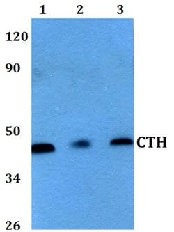 Invitrogen CTH Polyclonal Antibody 100 &mu;L; Unconjugated:Antibodies,