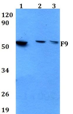 Factor IX Polyclonal Antibody:Antibodies, Polyclonal