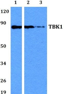 Invitrogen TBK1 Polyclonal Antibody 100 &mu;L; Unconjugated:Antibodies,
